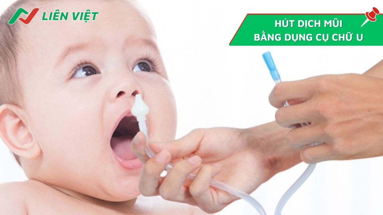 Hút dịch mũi cho trẻ sơ sinh bằng dụng cụ hút chữ U