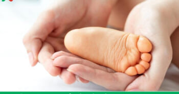 vàng da sơ sinh pdf